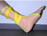 Splint