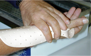 Moulding the orthosis