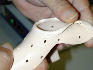 Reheating the orthosis
